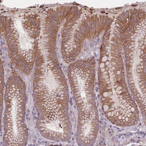 Anti-HSBP1L1 antibody produced in rabbit 