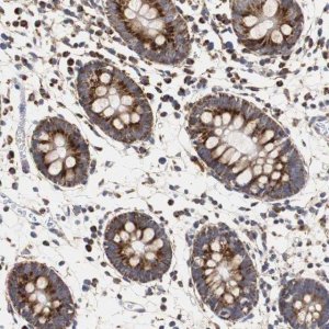 Anti-HSD17B10 antibody produced in rabbit 