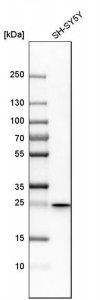 Anti-HSD17B10 antibody produced in rabbit 