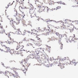 Anti-HSD17B7 antibody produced in rabbit 