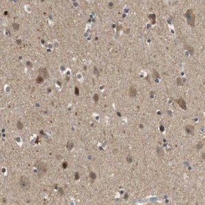 Anti-HSPA13 antibody produced in rabbit 