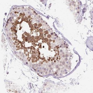 Anti-HSPA1A antibody produced in rabbit 