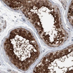 Anti-HSPA6 antibody produced in rabbit 