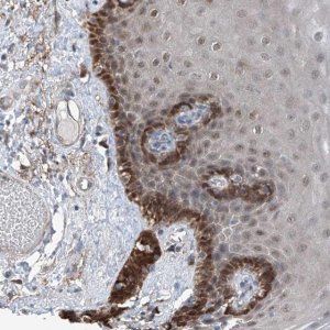 Anti-HSPA6 antibody produced in rabbit 