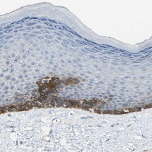 Anti-HTR1F antibody produced in rabbit 