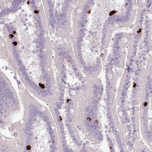 Anti-HTR3E antibody produced in rabbit 