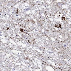 Anti-HTR7 antibody produced in rabbit 