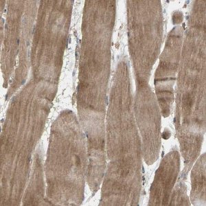 Anti-HTRA3 antibody produced in rabbit 
