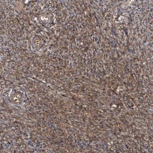Anti-HYI antibody produced in rabbit 