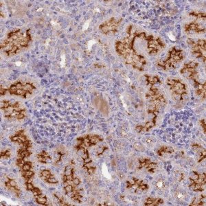 Anti-HYKK antibody produced in rabbit 