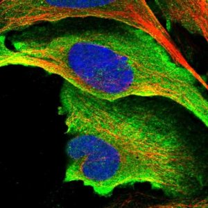 Anti-HYLS1 antibody produced in rabbit 