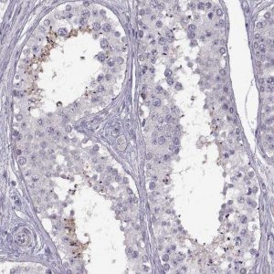 Anti-HYPM antibody produced in rabbit 