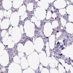 Anti-IBTK antibody produced in rabbit 