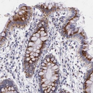 Anti-ICK antibody produced in rabbit 