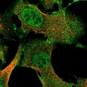 Anti-IFFO2 antibody produced in rabbit 