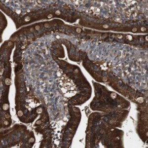 Anti-IFFO2 antibody produced in rabbit HPA015987-100UL