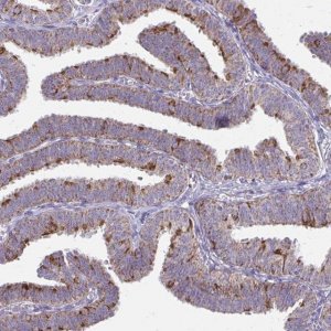 Anti-IFIT1 antibody produced in rabbit 