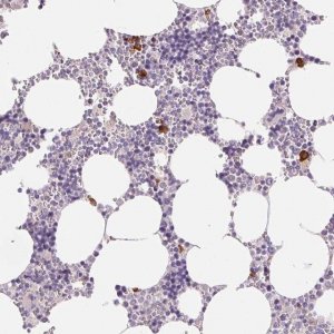 Anti-IFIT1B antibody produced in rabbit 