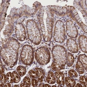 Anti-IFT122 antibody produced in rabbit 