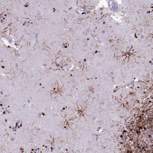 Anti-IFT172 antibody produced in rabbit 