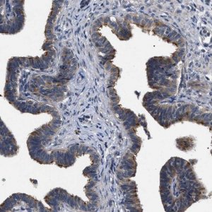 Anti-IFT81 antibody produced in rabbit 