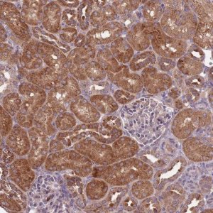Anti-IGF2BP2 antibody produced in rabbit 
