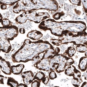 Anti-IGF2BP3 antibody produced in rabbit 