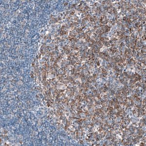 Anti-IGF2BP3 antibody produced in rabbit 
