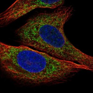 Anti-IGFBP2 antibody produced in rabbit 