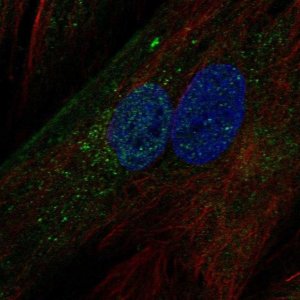 Anti-IGFBP5 antibody produced in rabbit 