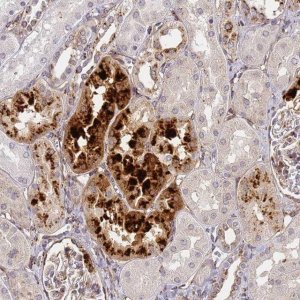 Anti-IGFBP7 antibody produced in rabbit 