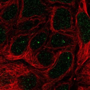 Anti-IGHMBP2 antibody produced in rabbit 