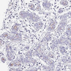 Anti-IGSF23 antibody produced in rabbit 