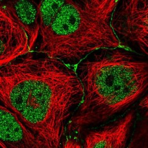 Anti-IGSF23 antibody produced in rabbit 