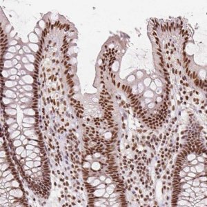 Anti-IK antibody produced in rabbit 