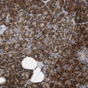 Anti-IKBKE antibody produced in rabbit 