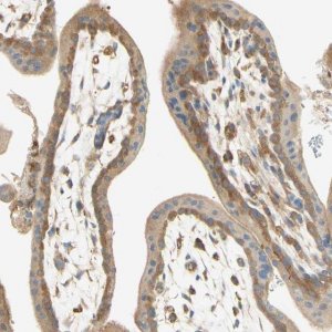 Anti-IKBKG antibody produced in rabbit 
