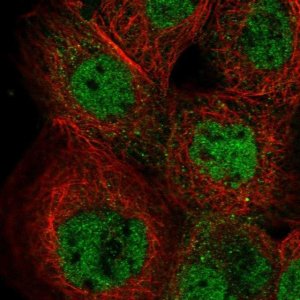 Anti-IKZF5 antibody produced in rabbit 