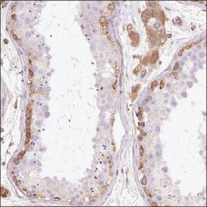 Anti-IL10RB antibody produced in rabbit HPA047550-100UL
