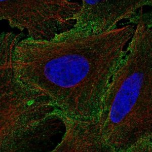 Anti-IL12RB1 antibody produced in rabbit 