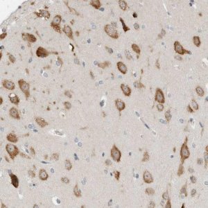 Anti-IL12RB2 antibody produced in rabbit 