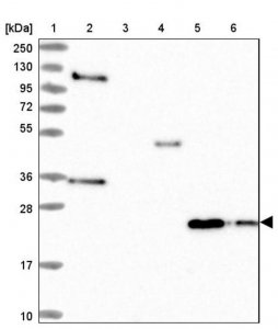 Anti-IL17B antibody produced in rabbit 