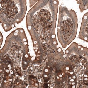 Anti-IL17RE antibody produced in rabbit 