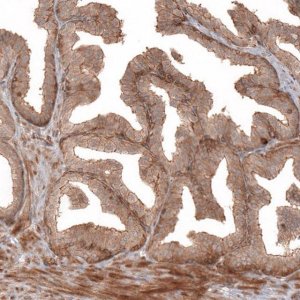 Anti-IL17RE antibody produced in rabbit 