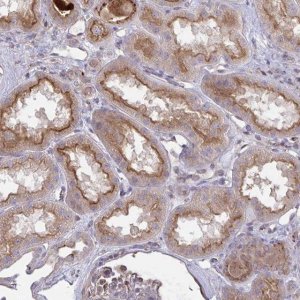 Anti-IL1R1 antibody produced in rabbit 