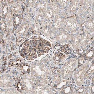 Anti-IL1RL1 antibody produced in rabbit 