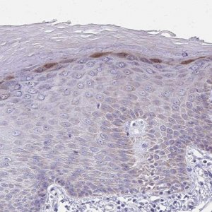 Anti-IL37 antibody produced in rabbit 