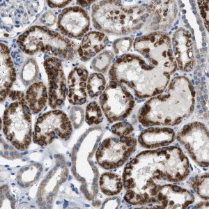 Anti-ILDR1 antibody produced in rabbit 