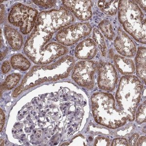 Anti-IMMP1L antibody produced in rabbit 