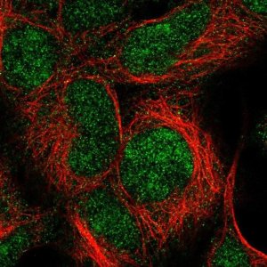 Anti-IMP3 antibody produced in rabbit 